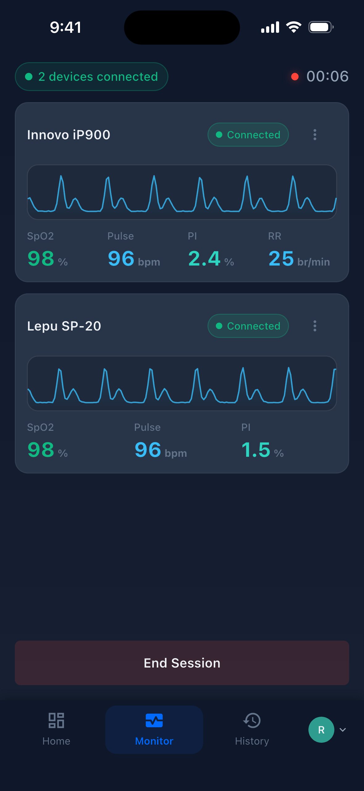 Dual-device monitoring: two oximeter cards live at once, one on a finger and one on a foot, each with its own vitals