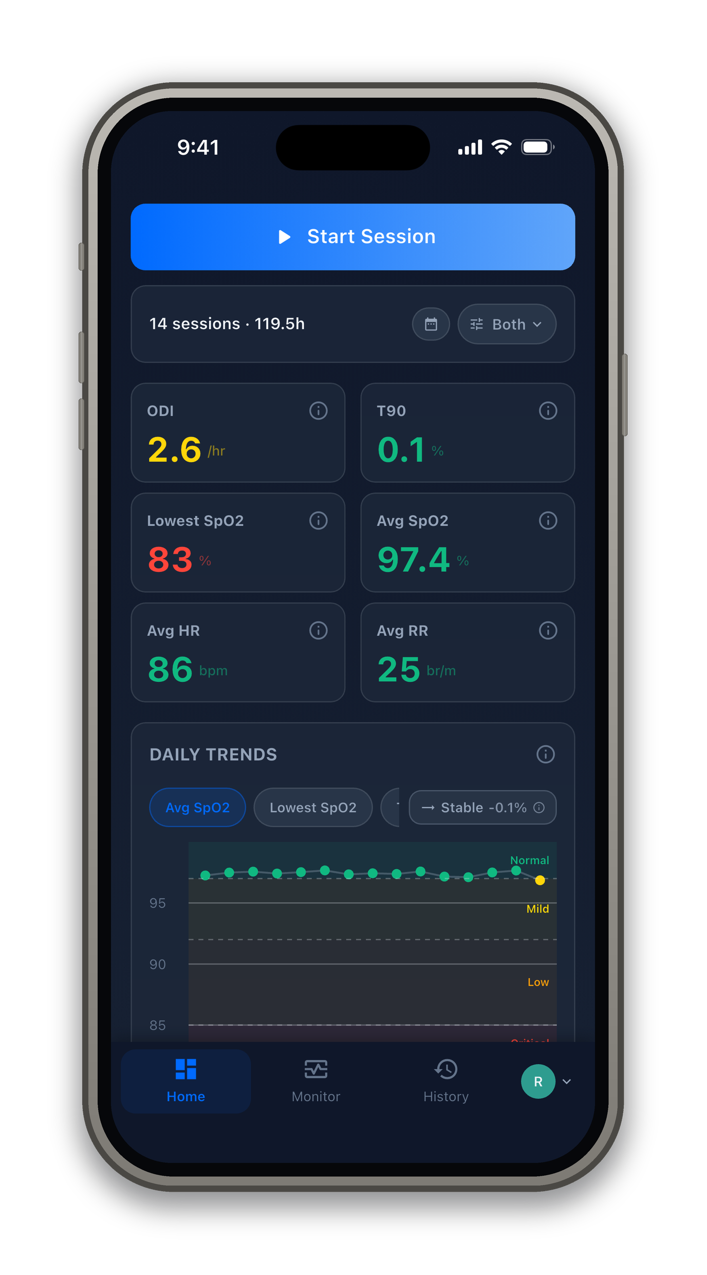 ApneaWatch — the home dashboard on iPhone with overnight metrics, a calendar heatmap, and trend charts (synthetic demo data)